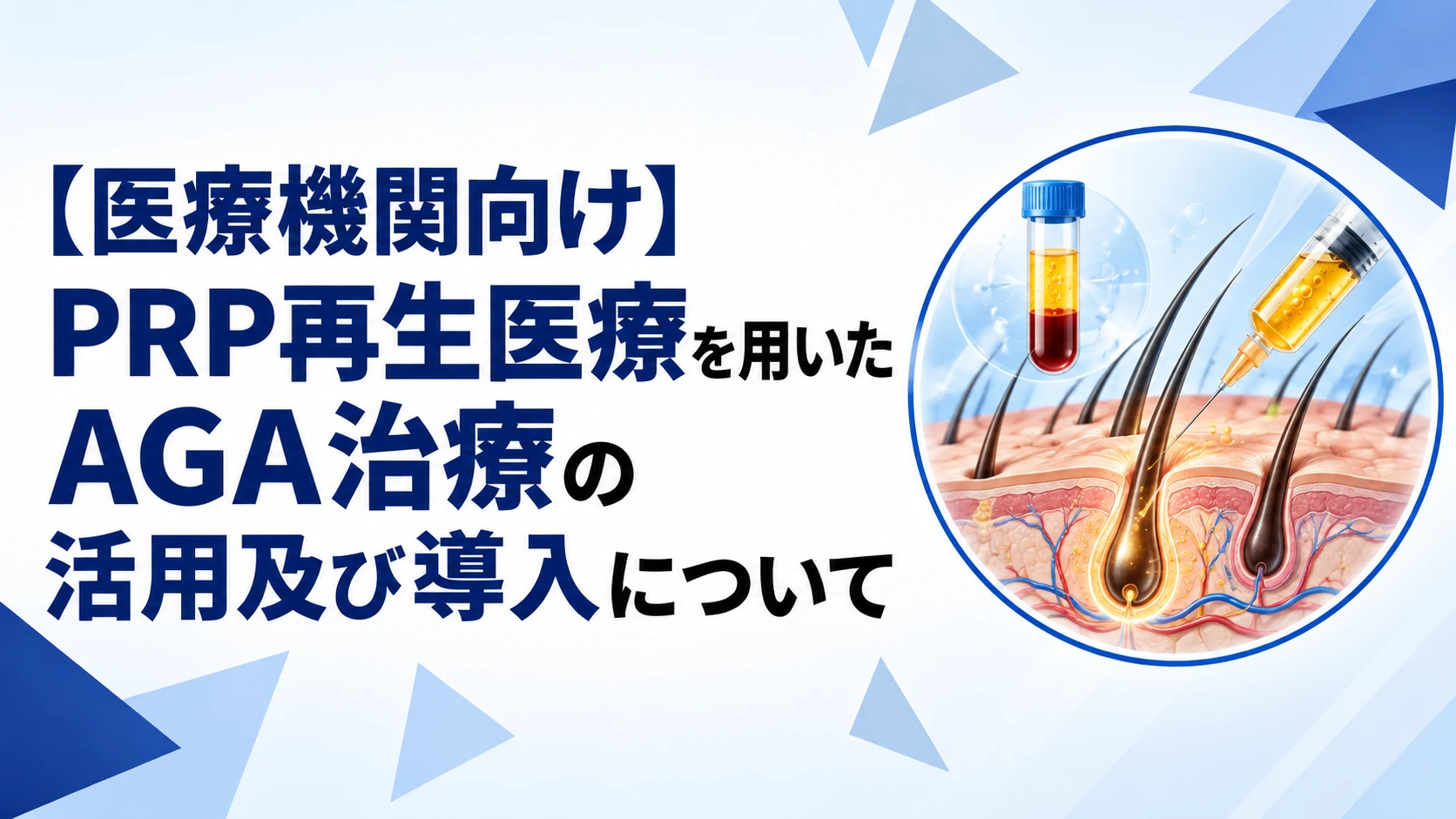【医療機関向け】PRP再生医療を用いたAGA治療の活用及び導入についてのサムネイル画像